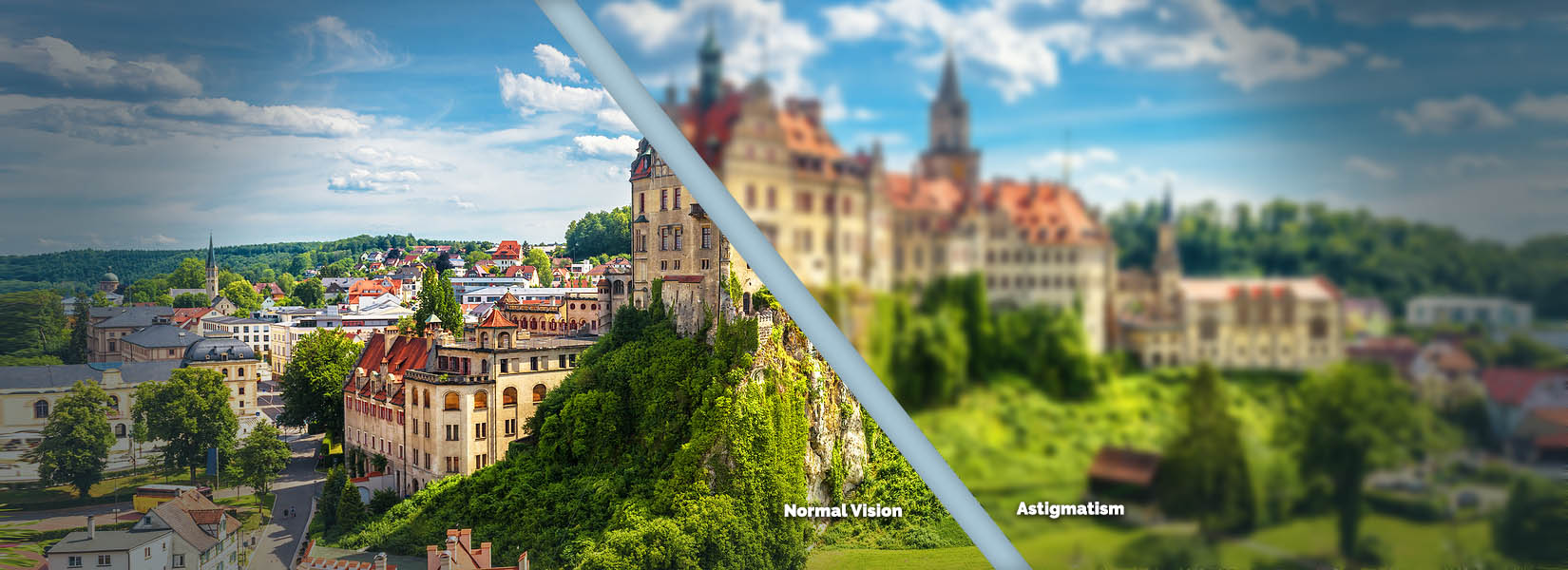 Astigmatism Treatment in Dallas